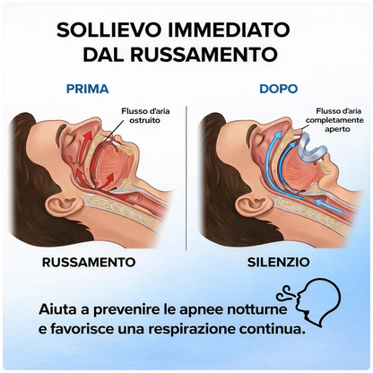Dispositivo orale anti-russamento